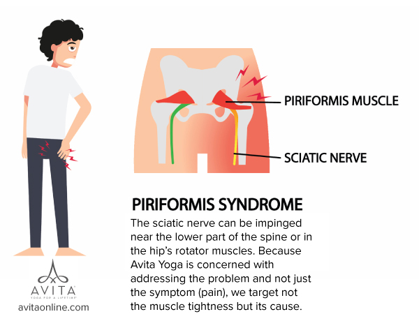 Resolving Sciatic Pain with Avita Yoga - Avita Online